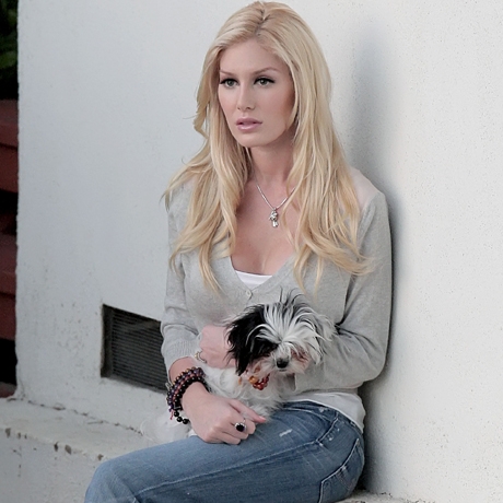heidi montag surgery gone wrong. star Heidi Montag showed